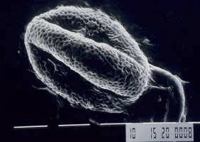 Grain de pollen sub-fossile de sarrasin "Fagopyrum esculentum" vu au microscope électronique d'une t
